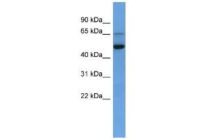 WB Suggested Anti-IQCB1 Antibody Titration: 0.