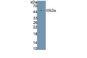 Detection of Recombinant CHIKV, Human using Monoclonal Antibody to Chikungunya Virus (CHIKV) (Chikungunya Virus (CHIKV) antibody)