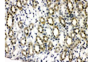 Anti- TCPTP Picoband antibody,IHC(P) IHC(P): Rat Kidney Tissue (PTPN2 antibody  (AA 1-330))