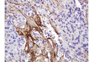 Image no. 1 for anti-GTPase NRas (NRAS) antibody (ABIN1499821) (GTPase NRas antibody)
