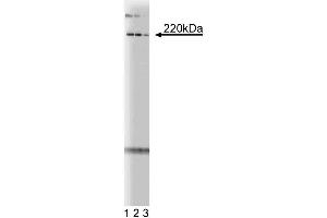 Western blot analysis of pericentrin on mouse neonate lysate. (PCNT antibody  (AA 1692-1814))