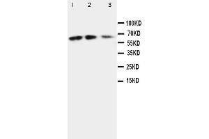 Anti-CX3CL1 antibody, Western blotting Lane 1: Recombinant Mouse Fractalkin Protein 10ng Lane 2: Recombinant Mouse Fractalkin Protein 5ng Lane 3: Recombinant Mouse Fractalkin Protein 2.