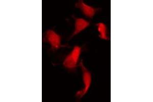 ABIN6267482 staining NIH-3T3 by IF/ICC. (Merlin antibody  (pSer518))
