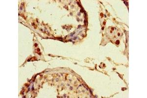 Immunohistochemistry of paraffin-embedded human testis tissue using ABIN7150193 at dilution of 1:100 (LIG3 antibody  (AA 809-928))
