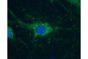 Expression of HCN1 in rat DRG primary culture - Immunocytochemical staining of paraformaldehyde-fixed and permeabilized rat DRG primary culture. (HCN1 antibody  (Intracellular, N-Term))