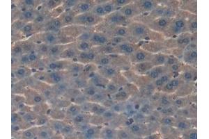 Detection of HGD in Mouse Liver Tissue using Polyclonal Antibody to Homogentisate-1,2-Dioxygenase (HGD) (HGD antibody  (AA 190-429))