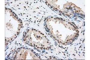 Image no. 11 for anti-Transforming, Acidic Coiled-Coil Containing Protein 3 (TACC3) antibody (ABIN1498099) (TACC3 antibody)