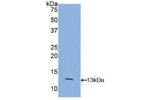 Detection of Recombinant MCP2, Mouse using Polyclonal Antibody to Monocyte Chemotactic Protein 2 (MCP2) (CCL8 antibody  (AA 20-94))