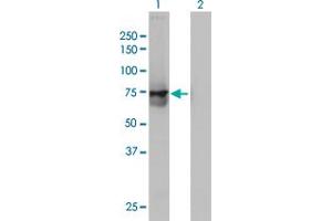 Western Blot analysis of ACOX2 expression in transfected 293T cell line by ACOX2 monoclonal antibody (M01), clone 1D1. (Acox2 antibody  (AA 582-681))