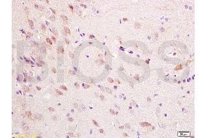 Formalin-fixed and paraffin embedded rat brain tissue labeled with Anti-ChRM1/Acetylcholine receptor(M1) Polyclonal Antibody, Unconjugated (ABIN738396) at 1:200 followed by conjugation to the secondary antibody, (SP-0023), and DAB staining (CHRM1 antibody  (AA 321-420))