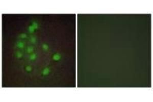 Immunofluorescence analysis of A549 cells, using HAND1 antibody. (HAND1 antibody)