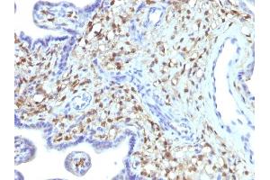 Formalin-fixed, paraffin-embedded human Placenta stained with S100A4 Mouse Monoclonal Antibody (S100A4/1481).