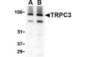 Western Blotting (WB) image for anti-Transient Receptor Potential Cation Channel, Subfamily C, Member 3 (TRPC3) (C-Term) antibody (ABIN1030778) (TRPC3 antibody  (C-Term))