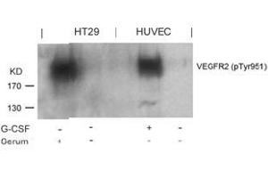 Image no. 2 for anti-VEGF Receptor 2 (VEGFR2) (pTyr951) antibody (ABIN196771) (VEGFR2/CD309 antibody  (pTyr951))