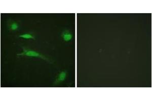 Immunofluorescence analysis of HeLa cells, using p53 (Ab-20) Antibody. (p53 antibody  (AA 10-59))