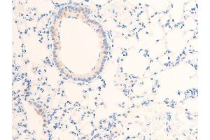 Immunohistochemistry (IHC) image for anti-Epidermal Growth Factor Receptor (EGFR) (pSer1071) antibody (ABIN6256098)