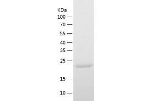 Western Blotting (WB) image for DiGeorge Syndrome Critical Region Gene 6 (DGCR6) (AA 1-220) protein (His tag) (ABIN7287171) (DGCR6 Protein (AA 1-220) (His tag))