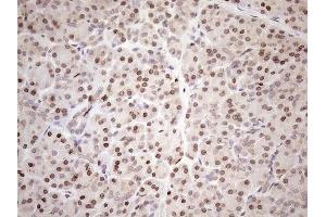 Immunohistochemistry (IHC) image for anti-Achalasia, Adrenocortical Insufficiency, Alacrimia (AAAS) (AA 322-546) antibody (ABIN2715861) (Adracalin antibody  (AA 322-546))