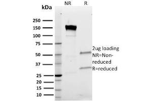 SDS-PAGE Analysis Purified Band III Mouse Monoclonal Antibody (Q1/156). (Band 3/AE1 antibody)