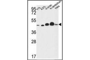 Western blot analysis of NDUFS2 Antibody (Center) in Y79,A375,Hela cell line and mouse brain,cerebellum tissue lysates (35ug/lane).