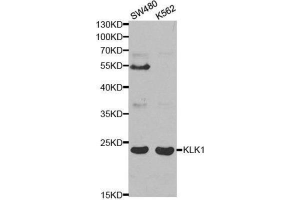 Kallikrein 1 antibody  (AA 25-262)