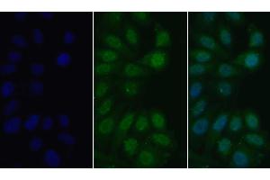 Detection of MyD88 in Human HepG2 cell using Polyclonal Antibody to Myeloid Differentiation Factor 88 (MyD88) (MYD88 antibody  (AA 32-265))