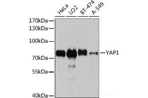 Western blot analysis of extracts of various cell lines using YAP1 Polyclonal Antibody at dilution of 1:1000.