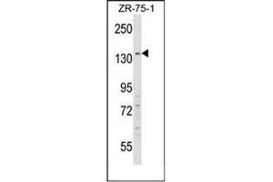 Western blot analysis of RFX1 Antibody (C-term) in ZR-75-1 cell line lysates (35ug/lane). (RFX1 antibody  (C-Term))