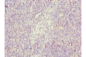 Immunohistochemistry of paraffin-embedded human thymus tissue using ABIN7154419 at dilution of 1:100 (GZMH antibody  (AA 20-246))
