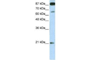 WB Suggested Anti-NFATC4 Antibody Titration:  1. (NFATC4 antibody  (Middle Region))