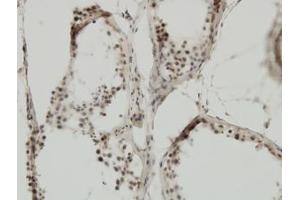 Image no. 5 for anti-Tripartite Motif Containing 24 (TRIM24) (AA 432-569) antibody (ABIN599067) (TRIM24 antibody  (AA 432-569))