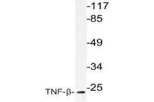Western blot (WB) analysis of TNF-beta antibody in extracts from COS-7cells.