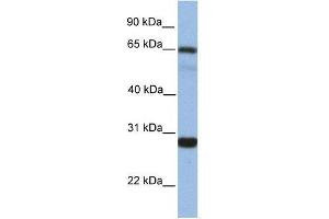 Western Blot showing MED4 antibody used at a concentration of 1. (MED4 antibody  (Middle Region))