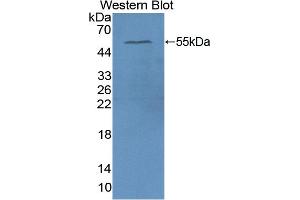 Detection of Recombinant APOA4, Human using Polyclonal Antibody to Apolipoprotein A4 (APOA4) (APOA4 antibody  (AA 173-396))