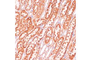 Immunohistochemistry of paraffin-embedded mouse kidney using Caspase-9 antibody (ABIN3016349, ABIN3016350, ABIN3016351 and ABIN6219728) at dilution of 1:100 (40x lens). (Caspase 9 antibody)