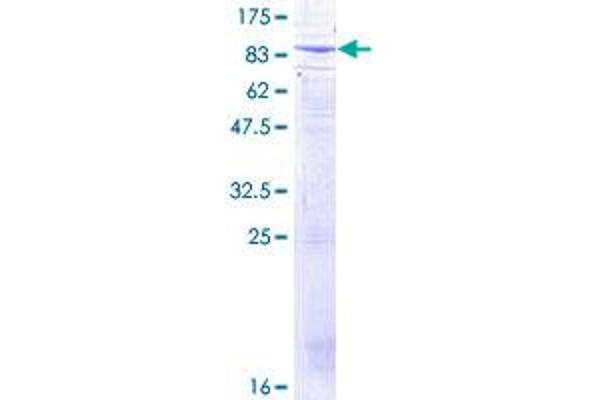 BTRC Protein (AA 1-605) (GST tag)