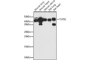 Western blot analysis of extracts of various cell lines, using TGFB2 antibody (ABIN1683015, ABIN3017925, ABIN3017926 and ABIN6220307) at 1:1000 dilution. (TGFB2 antibody  (AA 20-160))