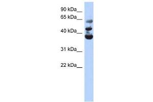 NSUN3 antibody used at 1 ug/ml to detect target protein. (NSUN3 antibody  (Middle Region))