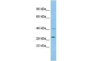 Host: Rabbit Target Name: ABHD14A Sample Type: 293T Whole Cell lysates Antibody Dilution: 1.