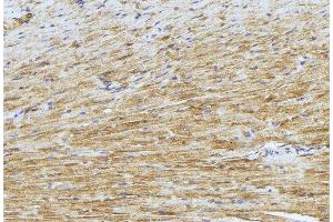 ABIN6277424 at 1/100 staining Mouse muscle tissue by IHC-P. (PDK4 antibody  (C-Term))