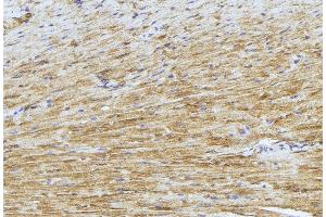 ABIN6277424 at 1/100 staining Mouse muscle tissue by IHC-P.