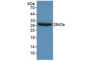 Detection of Recombinant Gelsolin, Human using Monoclonal Antibody to Gelsolin (GSN) (Gelsolin antibody  (AA 432-553))