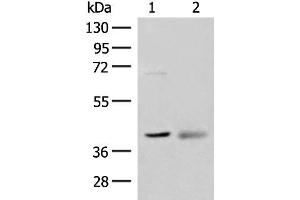 Western blot analysis of Mouse kidney tissue and Human fetal brain tissue lysates using ADH5 Polyclonal Antibody at dilution of 1:500 (ADH5 antibody)