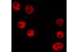 ABIN6275350 staining HepG2 by IF/ICC. (HELZ2 antibody  (C-Term))