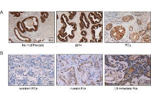 Immunostaining of XPNPEP2 expression in human prostate tissue. (XPNPEP2 antibody  (Center))