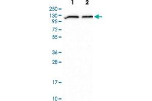 Western blot analysis of Lane 1: Human cell line RT-4 Lane 2: Human cell line U-251MG with ADAR polyclonal antibody  at 1:500-1:1000 dilution.