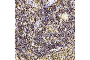 Immunohistochemical analysis of CD238 staining in human spleen formalin fixed paraffin embedded tissue section. (KEL antibody)