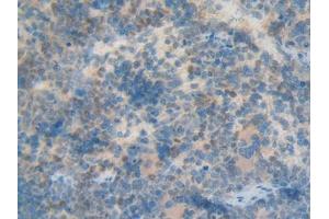 Used in DAB staining on fromalin fixed paraffin- embedded kidney tissue (KRT12 antibody  (AA 398-456))