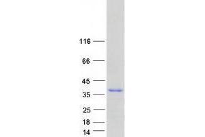 Validation with Western Blot (TXNDC5 Protein (Transcript Variant 1) (Myc-DYKDDDDK Tag))