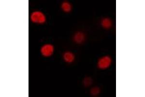 ABIN6274332 staining Hela cells by IF/ICC. (CHAF1B antibody  (N-Term))